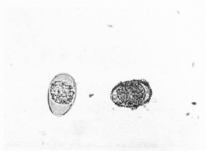 Oocysts of Eimeria sp. coccidium of cattle. Oocysts are shown X 400.