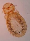 A microscopic view of a poultry louse, showing its tan, wingless, and segmented oval body with a broad head and six legs as it appears when found on chickens.