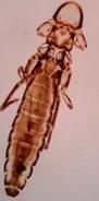 A microscopic view of a long, segmented, reddish-brown louse with a distinctively shaped head and jointed legs against a plain background.