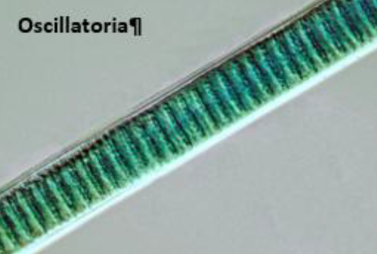 Microscopic view of Oscillatoria, showing a long filament of closely spaced green cells.