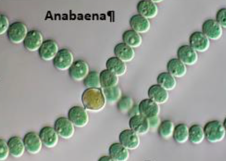 Microscopic view of Anabaena, showing chains of round green cells with a larger yellowish cell.
