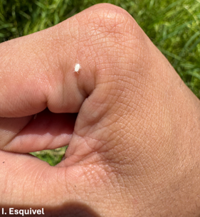 A small white pasture mealybug on a person's hand with 