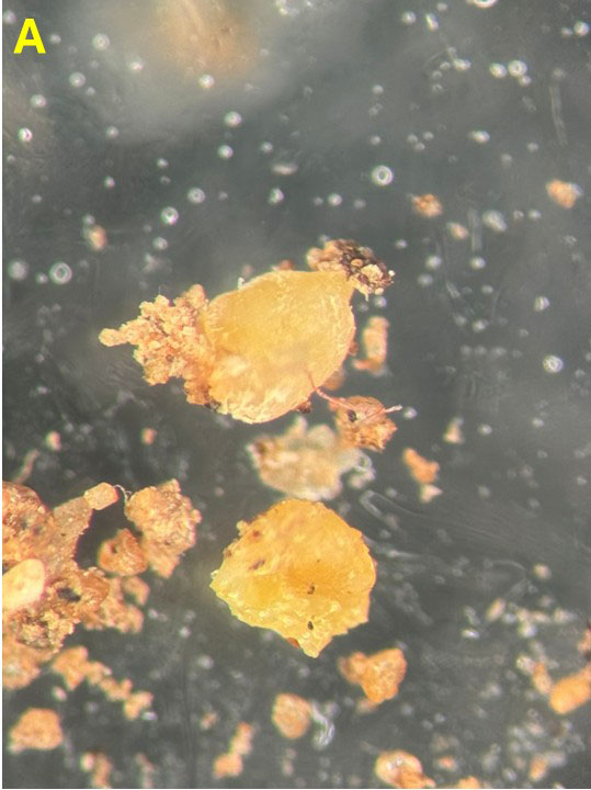Microscopic view of a cluster of irregular yellow-orange particles surrounded by smaller particles, with an “A” in the corner.