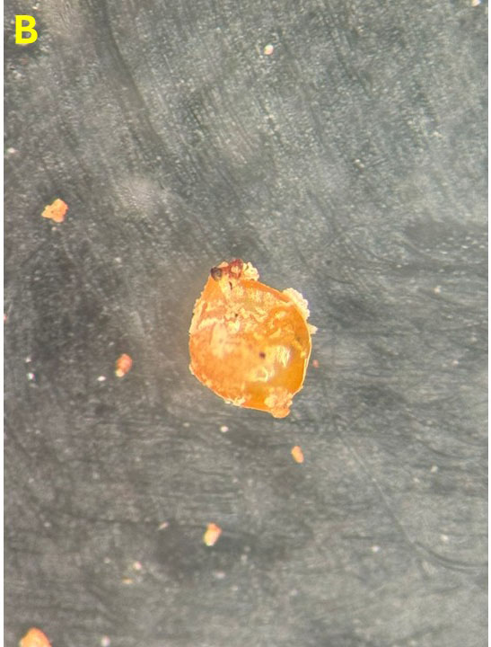 A microscopic image labeled B shows a large, irregular orange-yellow particle surrounded by smaller fragments on a dark, textured background.