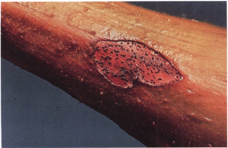 Development of fruiting structures of the black-rot fungus in a lesion on a leaf petiole.