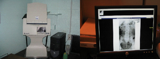 Teleradiology equipment examples of a digitizer and an electronic image.