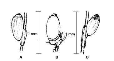 A head louse nit attached to hair, body louse nit attached to clothing fibers, and crab louse nit attached to hair. A head louse nit attached to hair, body louse nit attached to clothing fibers, and crab louse nit attached to hair.