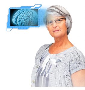Older woman with an x-ray of a brain near her head