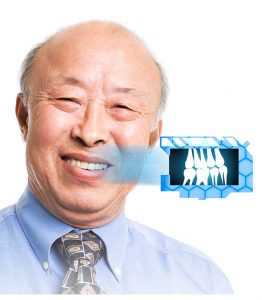 Older man with x-ray of teeth 