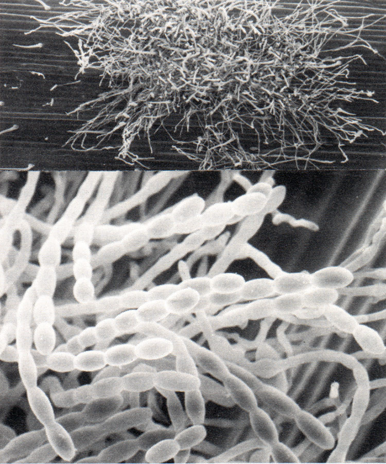 Powdery mildew, as seen in a scanning electron microscope.