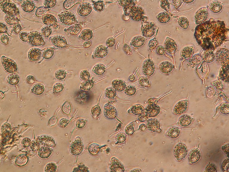 Sporangia of Phytophthora capsici scraped from watermelon rind with fruit rot.