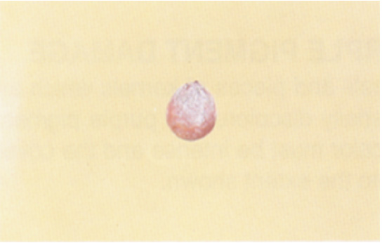 A kernel that has mold on its outer shell.