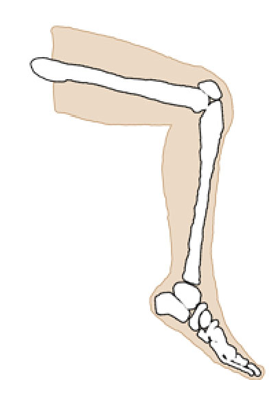 X-ray image of a leg.