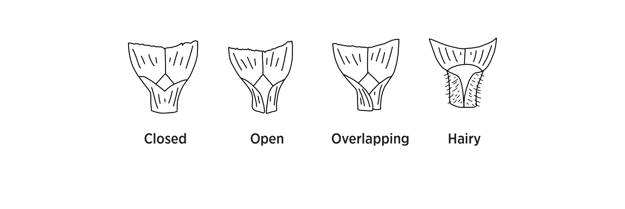 Four figures of different types of leaf sheaths, showing the difference between closed, open, overlapping and hairy.