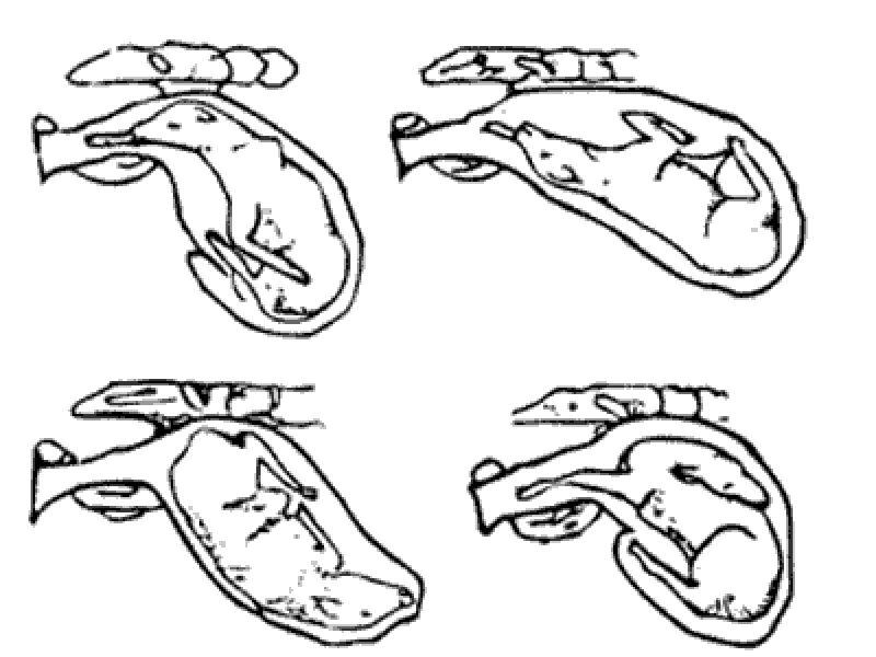 Four black and white sketches of the birth canal of a cow. Inside each of the canals is a calf, but in each, the calf has a different position. The top left has a calf with a body completely vertical and head towards the rear of the cow. The top right the calf is on its back and in a 45 degree angle. The bottom left shows the calf with its rear pointed toward the rear of the cow and its head toward the front of the cow's body. In the bottom right sketch, the calf has one limb in the smaller part of the canal, but the head is pointed away and back toward the front of the cow's body and abdomen.