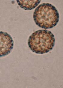 1000x view of common bunt.