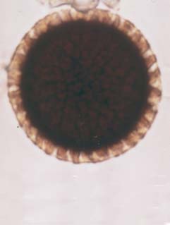 Karnal Bunt 1000x views.