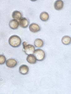 Loose smut 1000x view.