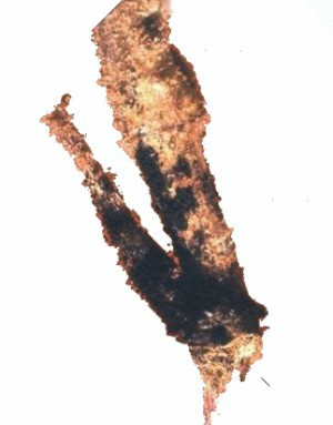 Aspergillus crown rot. 