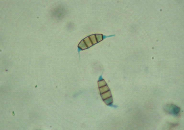 Microscopic view of seiridium canker. 