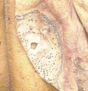 Close up of volutella blight. Close up of volutella blight.