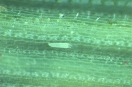 A single wheat curl mite viewed at 63x magnification.